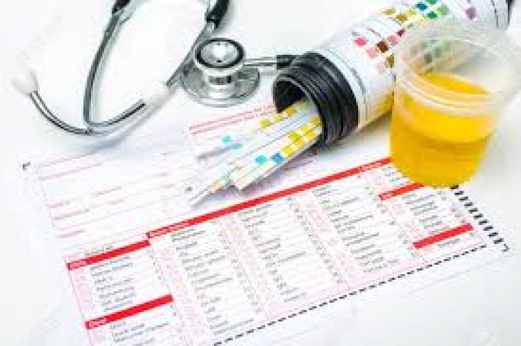 À quoi sert une bandelette urinaire ? France domicile